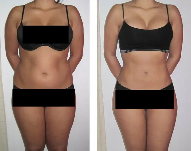 Before and After Massage