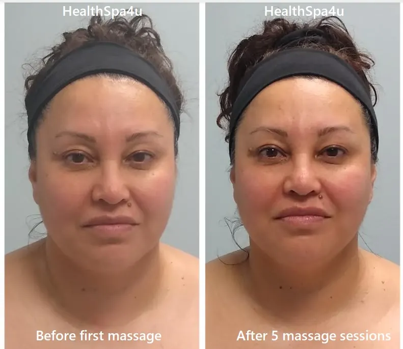 Before and After Cleint_7
