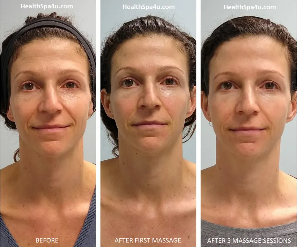 Before and After Massage Client _4