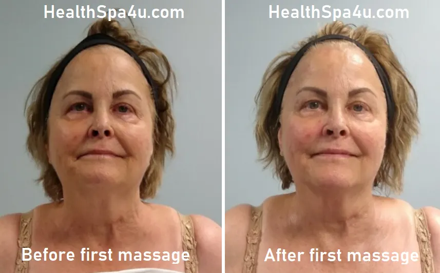 Before and After massage Client_2