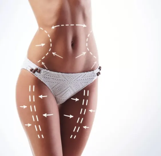 Fat lose, liposuction and cellulite removal concept